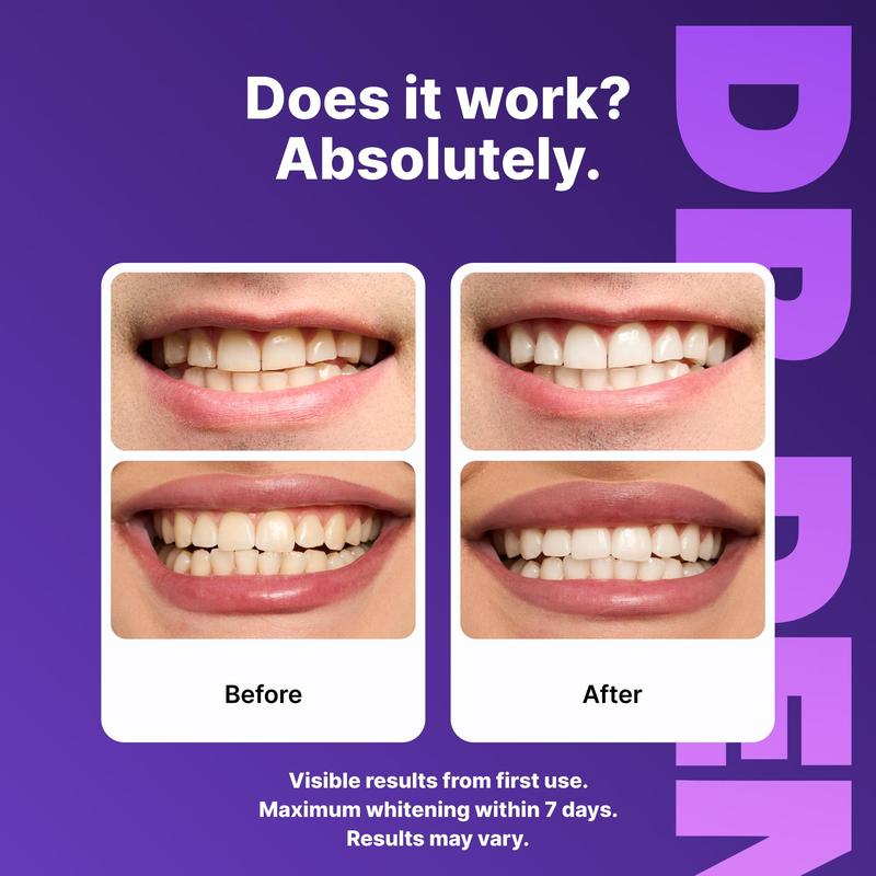 VELORA Purple Teeth Whitening Strips - 7/21 Whitening Sessions - Safe for Enamel - Non Sensitive Teeth Whitening - Peroxide-Free