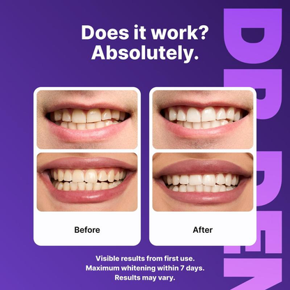 VELORA Purple Teeth Whitening Strips - 7/21 Whitening Sessions - Safe for Enamel - Non Sensitive Teeth Whitening - Peroxide-Free